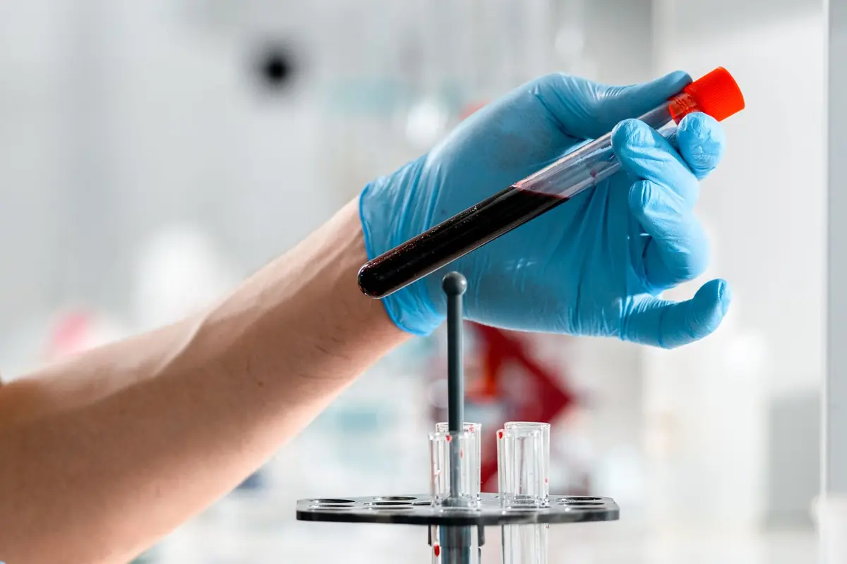 A gloved hand lifting a filled blood sample tube from a rack in a laboratory