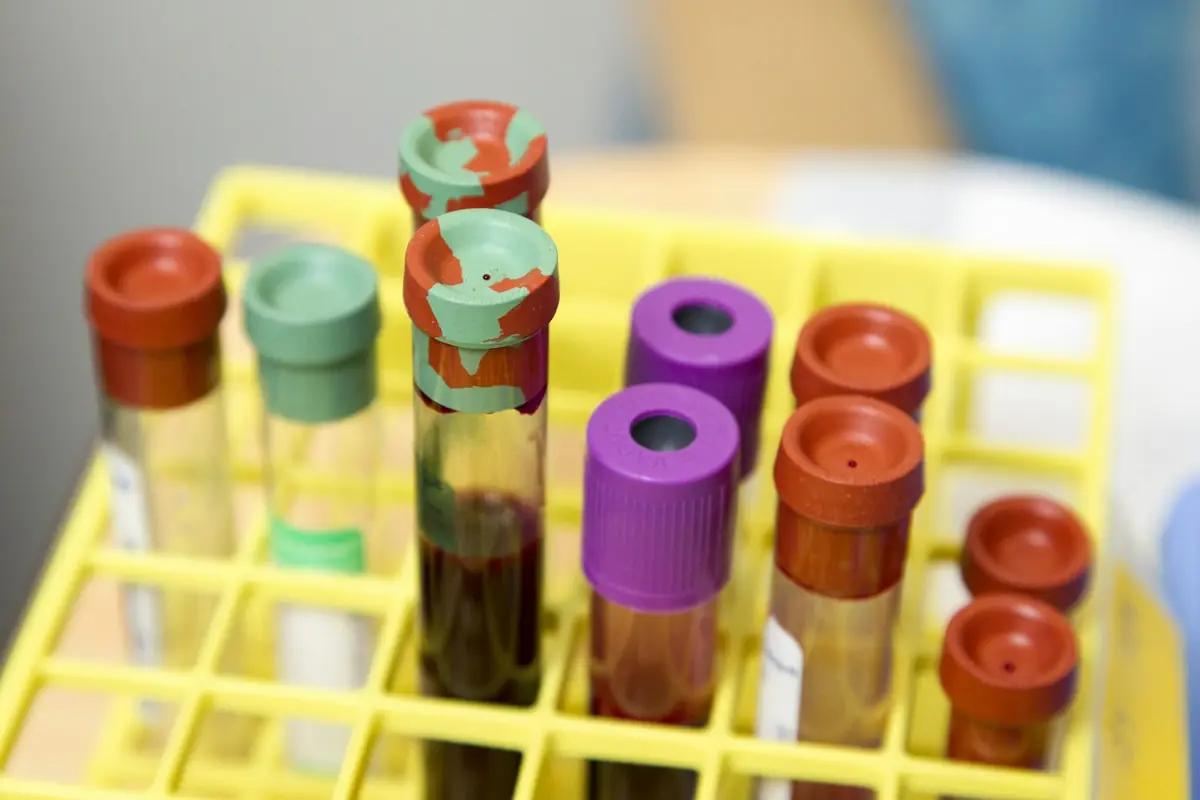 Blood sample tubes with coloured caps standing in a yellow rack